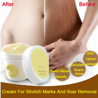 Cream for stretch marks and scar remover