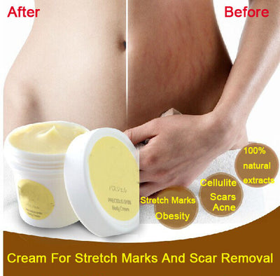 Cream for stretch marks and scar remover